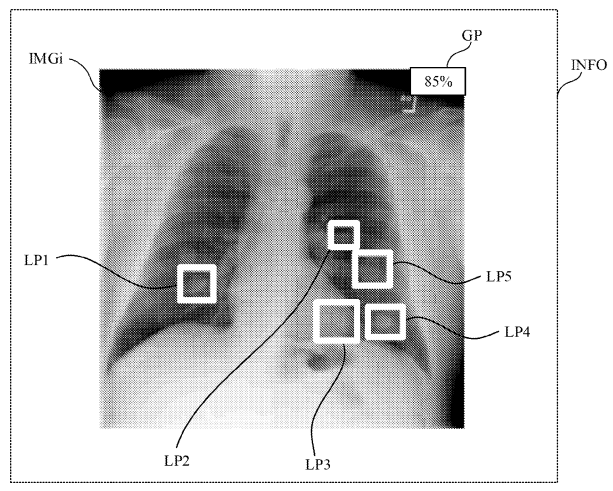 Thumbnail for US20230316511A1 patent
