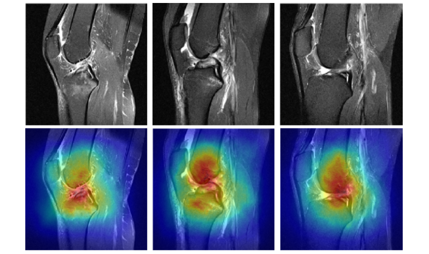 Thumbnail for ELNet paper